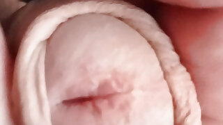 Peeling